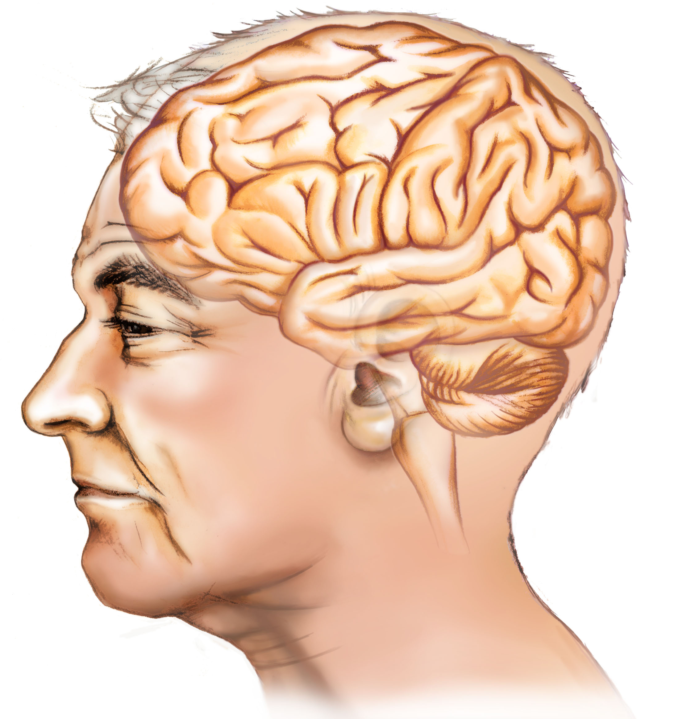 Mit Alzheimer-Erkrankten sicher zu Hause wohnen