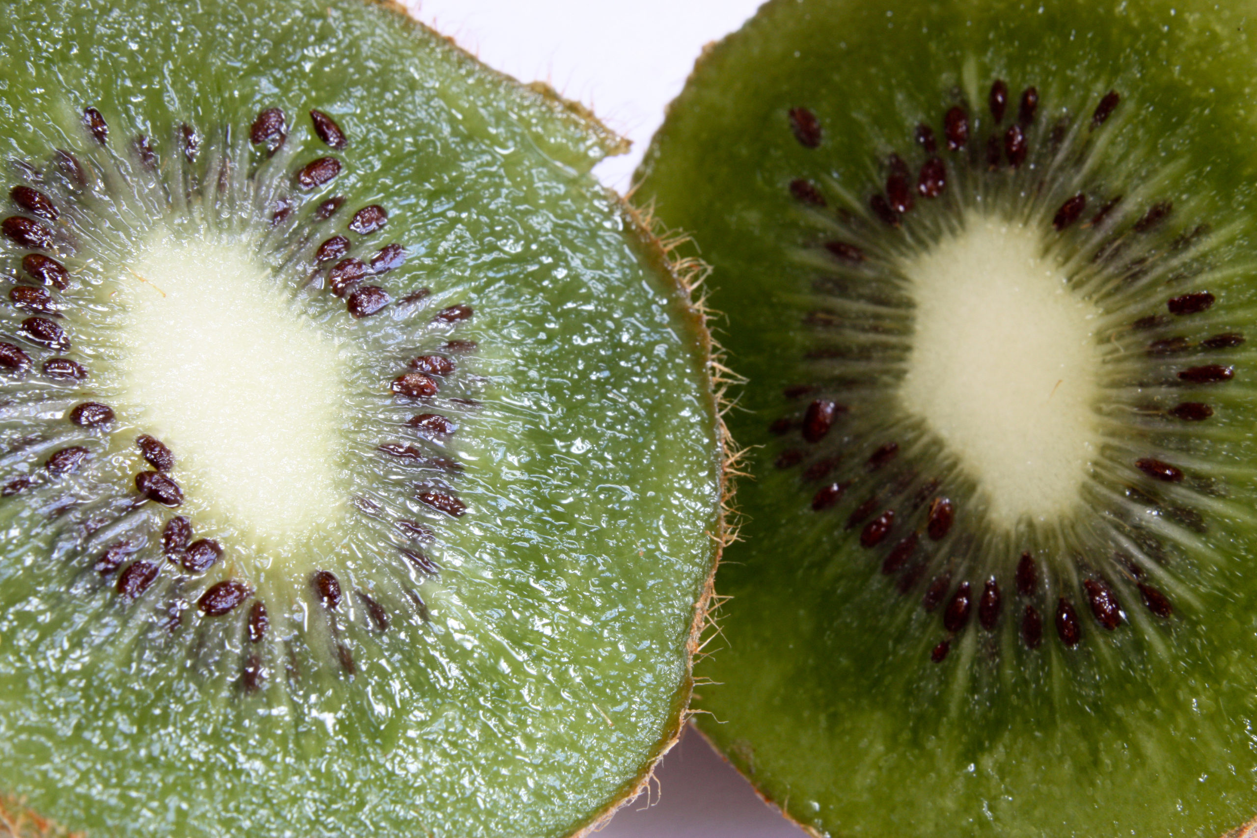 Völlegefühl: Kiwi statt Kräuterschnaps