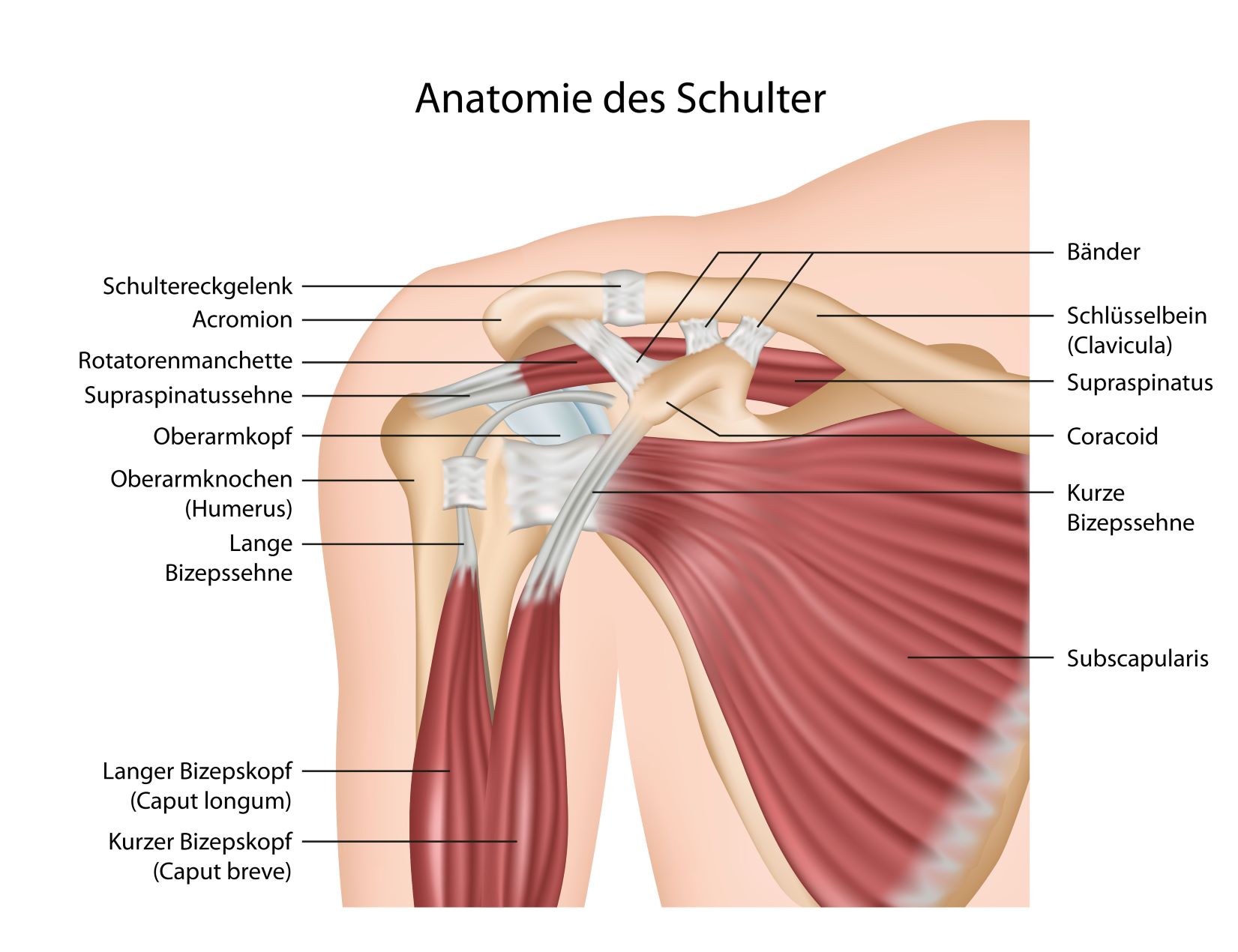 Sehnenriss in der Schulter: Reparatur mit Flechttechnik